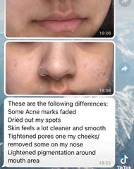 Cheeky Herbs Matcha Green Tea Face Mask